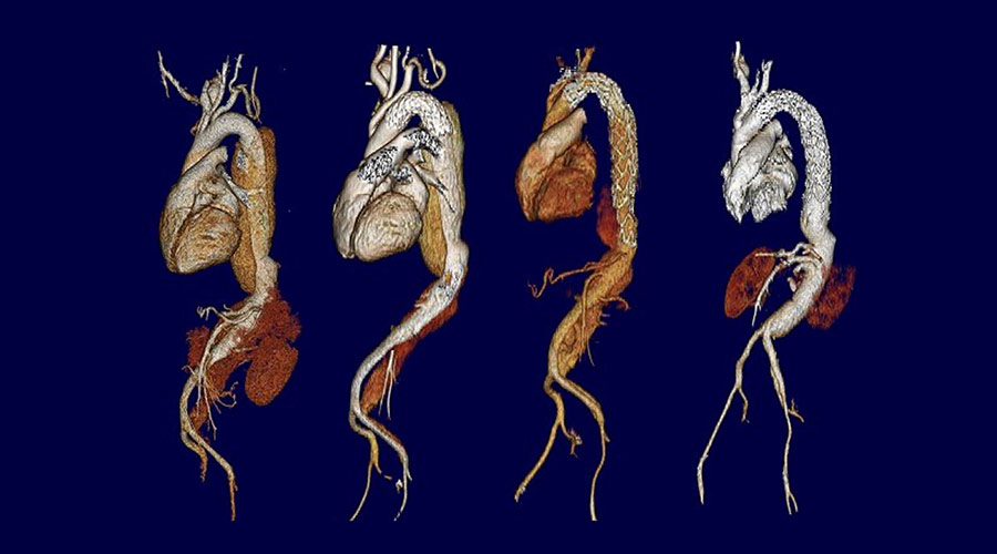 Heart Imaging - Cleveland Clinic London