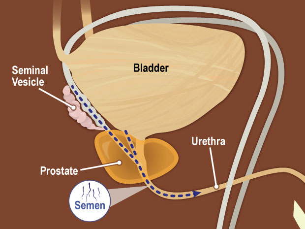 Located at the base of the bladder, the two seminal vesicles secrete a thick fluid that nourishes the sperm. The bladder is the muscular sac that stores urine (pee) until it is released through the urethra.  