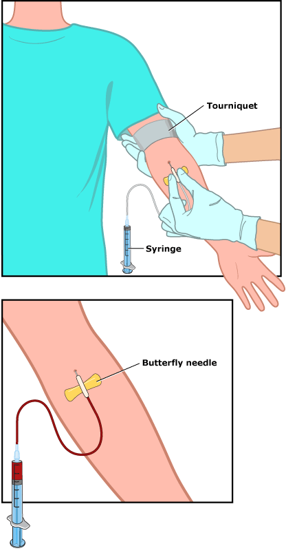 blood_test_illustration