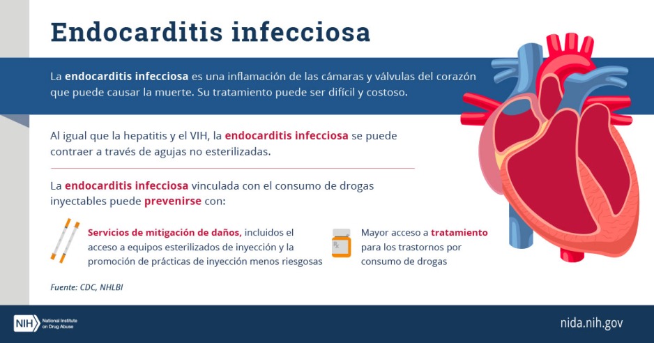 Esta gráfica contiene información básica sobre la endocarditis infecciosa, junto a una imagen anatómica de un corazón humano.