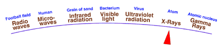 X-rays are very high on the energy meter.