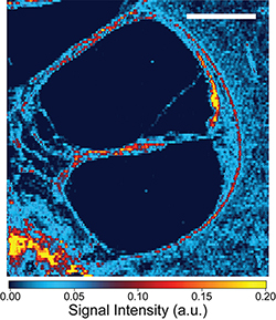 Localization of cisplatin in the human inner ear using laser ablation inductively-coupled plasma mass spectrometry (ICP-MS)