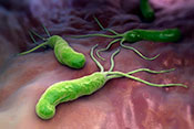 <em> H. pylori</em> treatment may raise risk of autoimmune disease