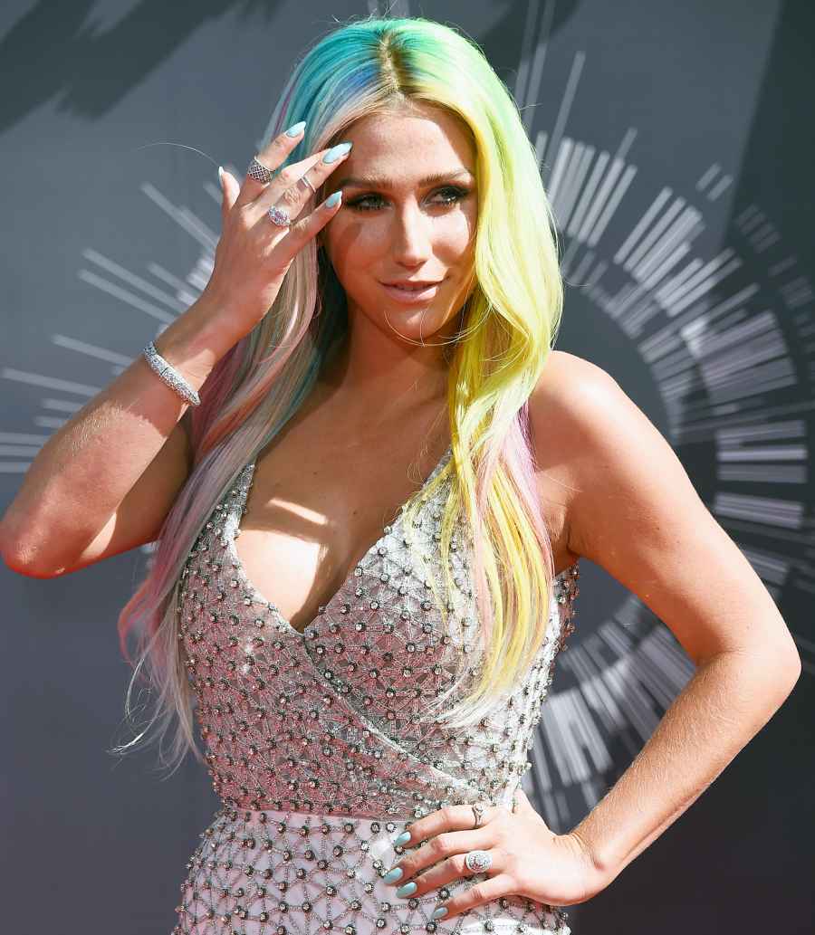 1413989735_kesha zoom