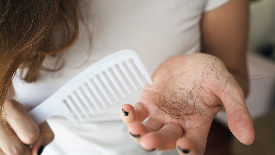 Woman losing hair on hairbrush in hand