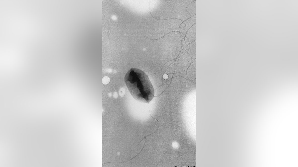 The ultrastructural morphology of a flagellated Escherichia coli O157:H7 bacterium