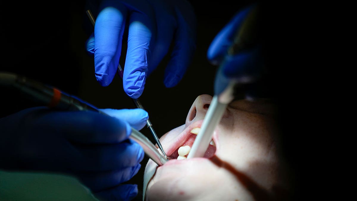 dentist working on patient