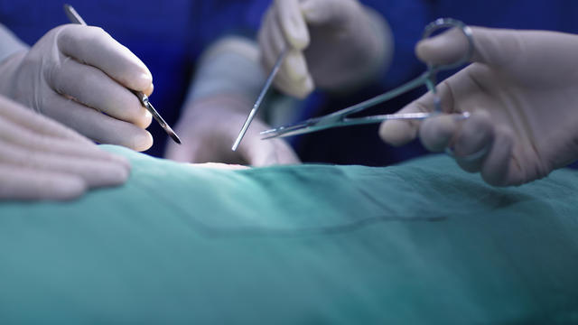 Hands of operating room staff performing surgery 