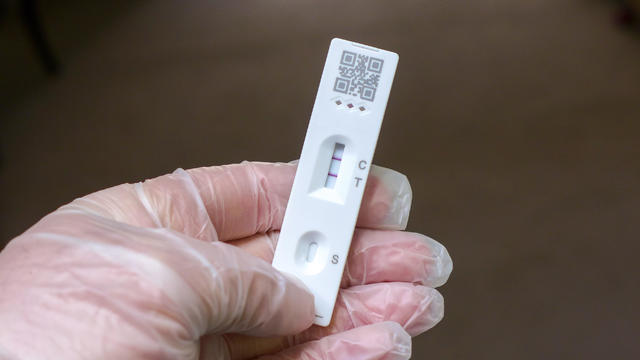 Positive Cassette rapid test for COVID-19, Test Result by Using Rapid Test Device for COVID-19 Novel Coronavirus. 