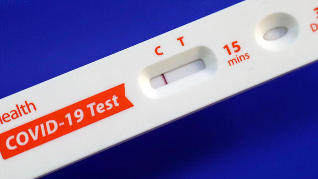 A COVID-19 antigen home test kit 