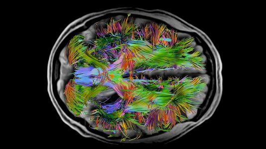 overlay of whole brain fibers