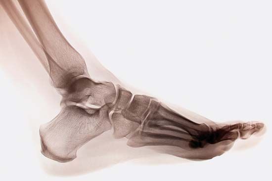 X-ray of a human ankle