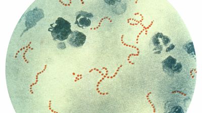 Streptococcus pyogenes