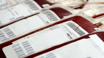 Transfused Human blood in storage