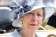 princess anne head injury symptoms