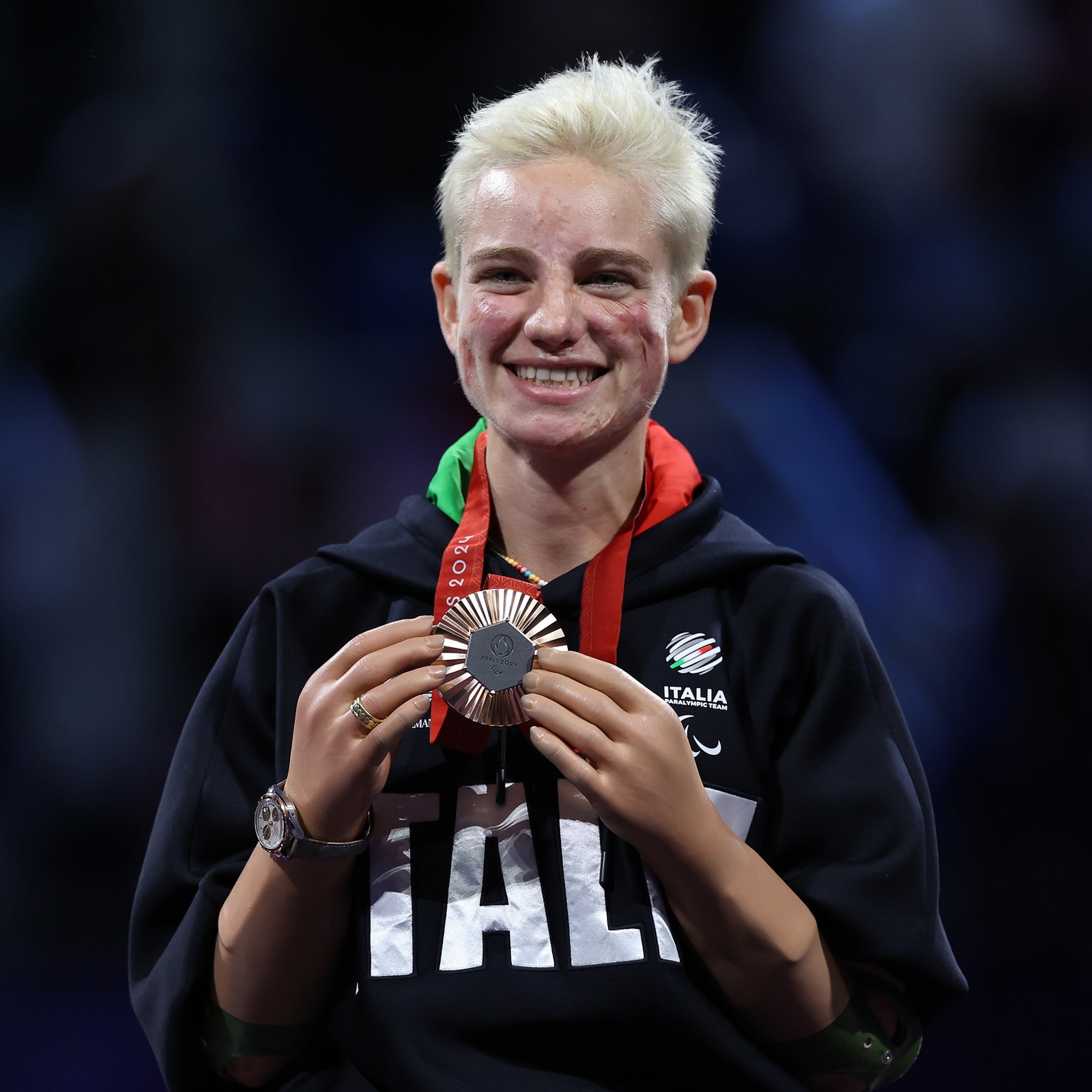 Bebe Vio, bronzo alle Paralimpiadi 2024 di Parigi: «Non sono le mie cicatrici. La mia storia è lo sport»