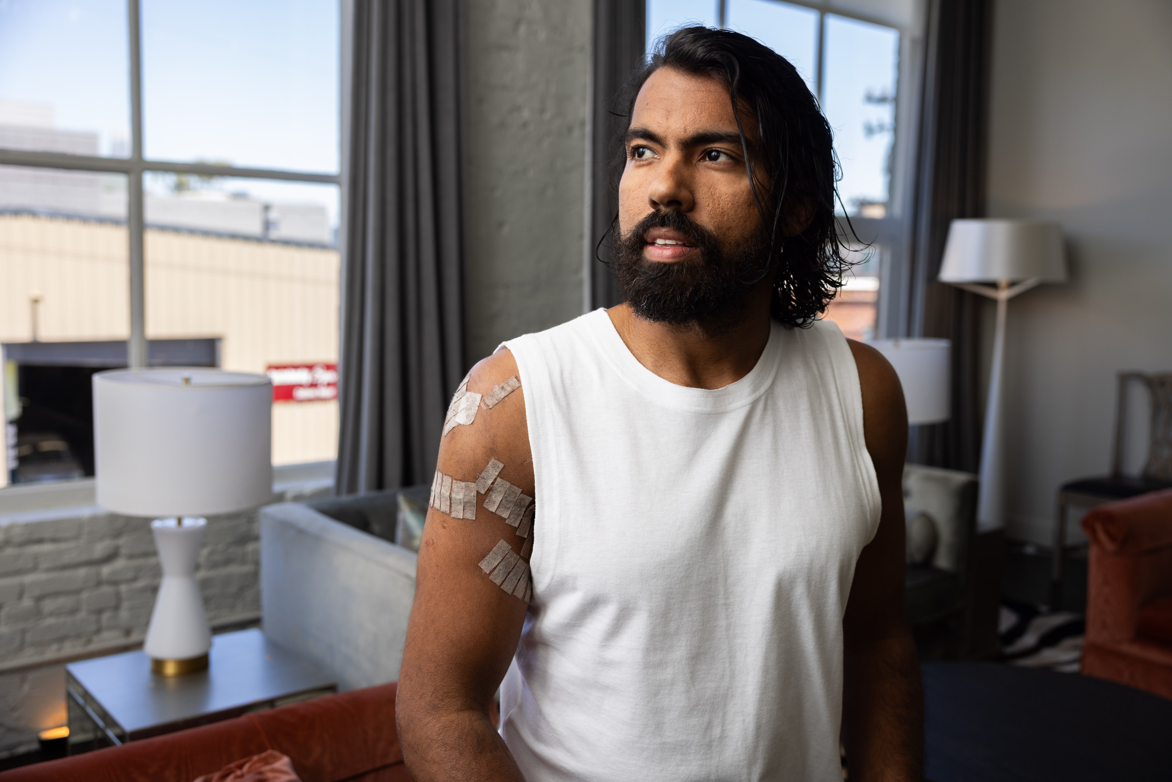 A bearded man with long hair and a white sleeveless shirt has several bandages on his arm. He stands indoors, next to a window with grey curtains.