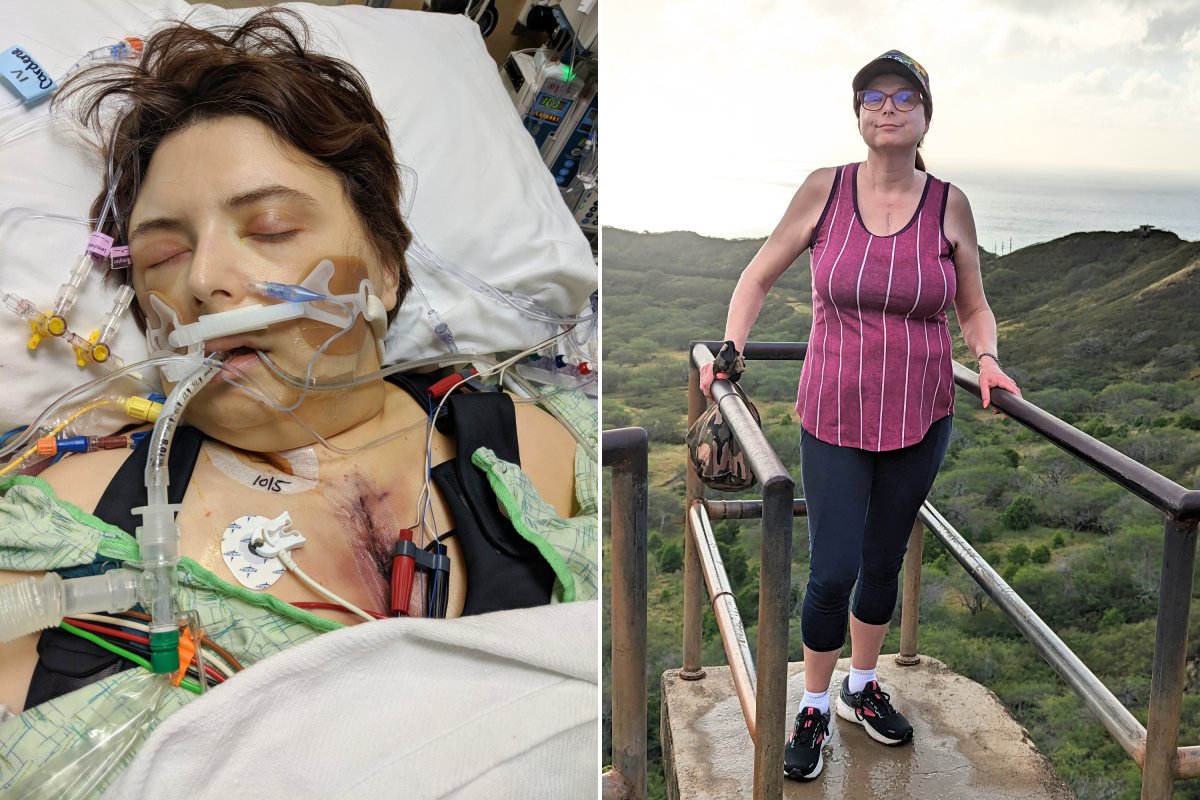 Dawn Levitt surgery and hiking