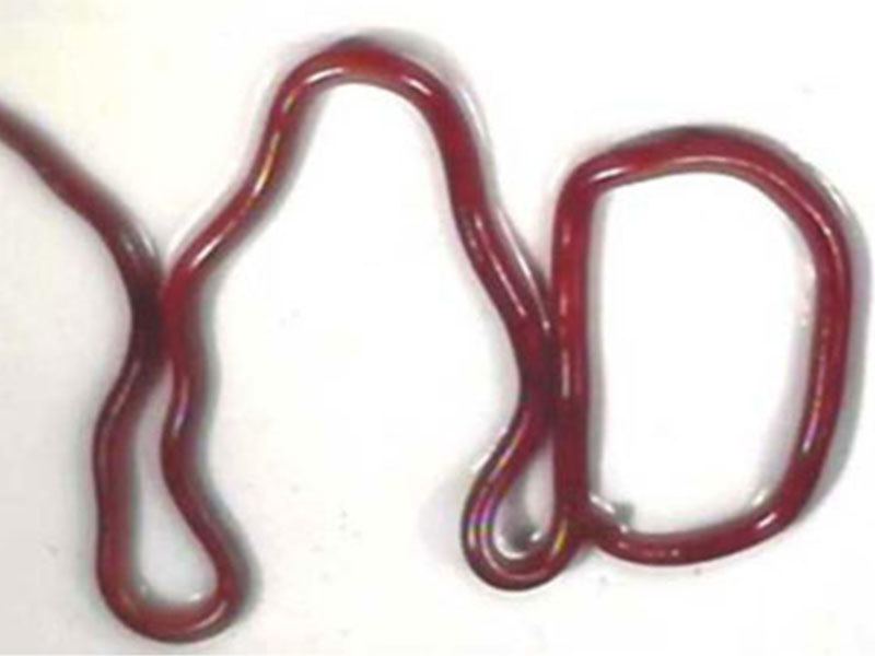 800X600 Urinary Tract Nematodes Dioctophyme Renale Adult