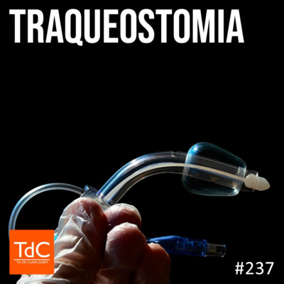 TdC 237: Traqueostomia - o que todo clínico precisa saber