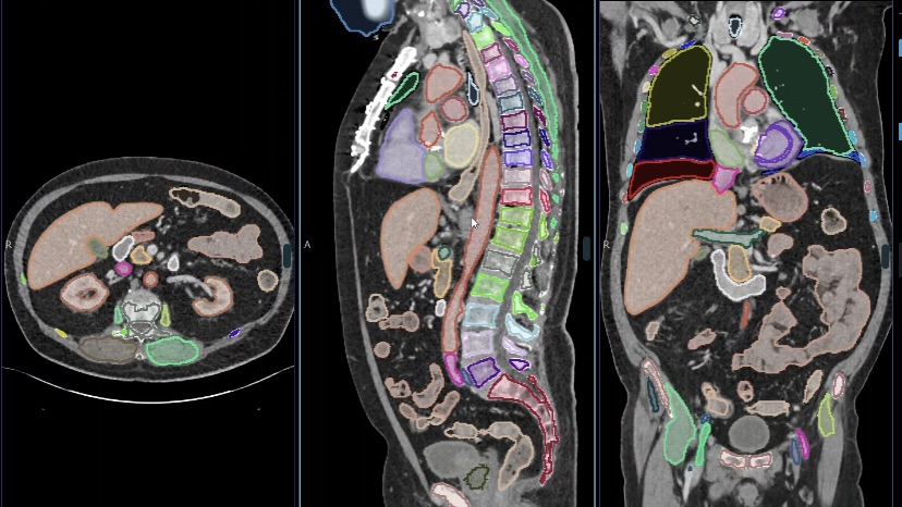 Three CT scan segments on a black background.