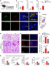 C5aR1 signaling on myeloid cells contributes to the lung pathology in a COV