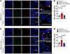 C5a/C5aR1 signaling is involved in the pathophysiology of COVID-19 through