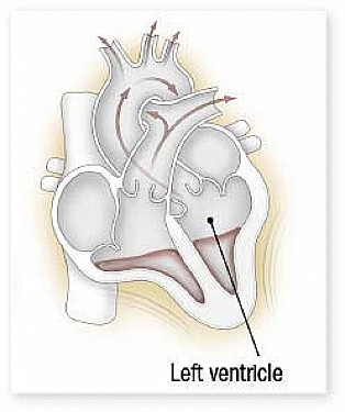 Can I improve my ejection fraction? featured image