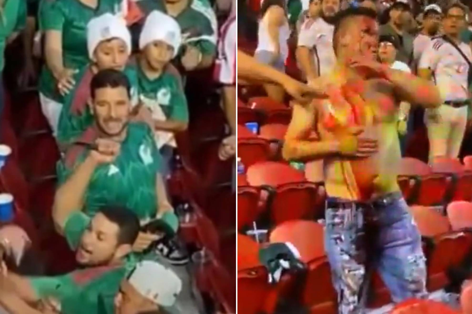 Mexican fan who was stabbed at Gold Cup tells hard-hitting story