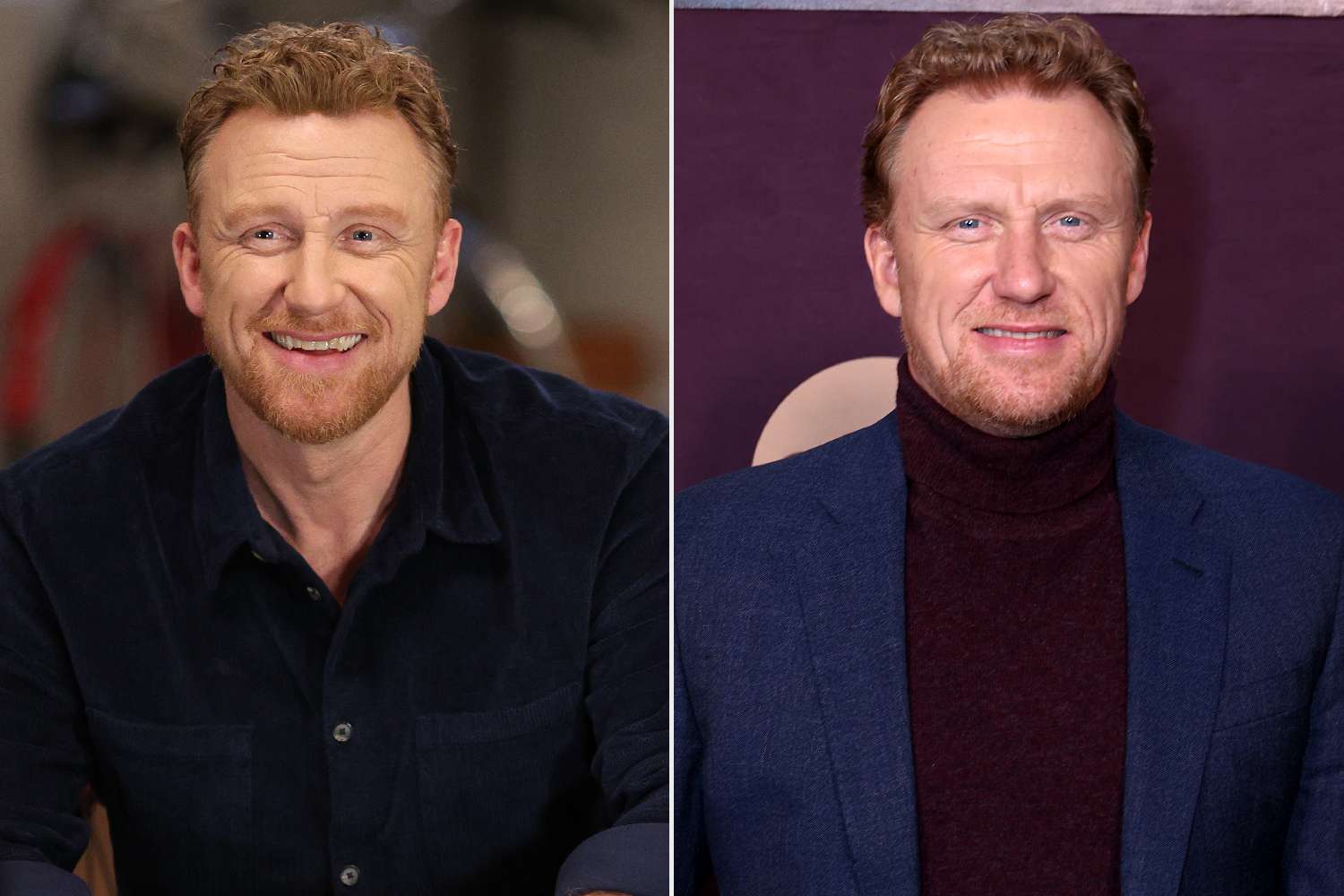 Greys Anatomy Where Are They Now; Kevin McKidd