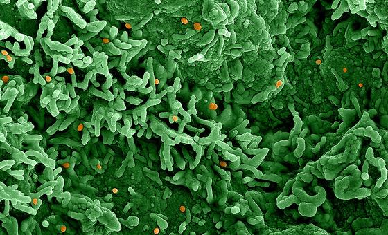 O vírus mpox (laranja) infecta células mostradas em verde