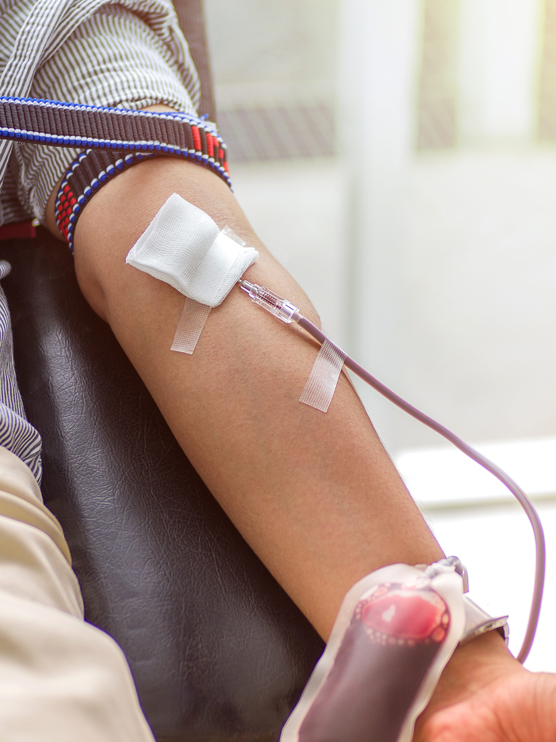 blood donor giving blood, closeup of arm with tube