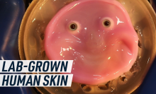 Artificial skin in the shape of a smiling face