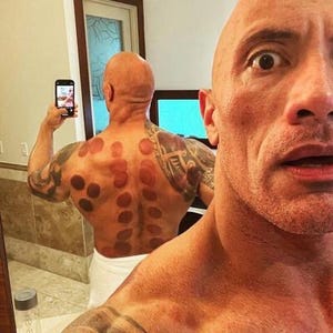 the rock, cupping para las lesiones y los músculos de la espalda