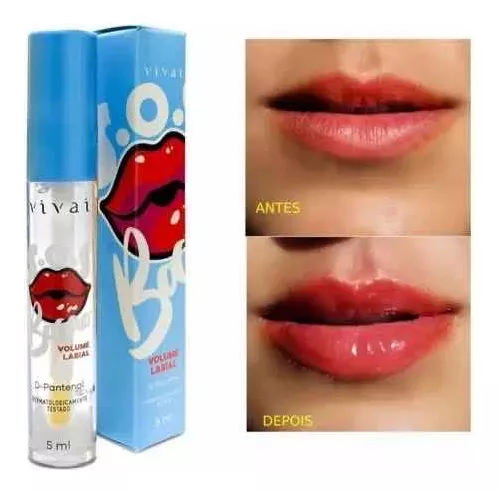 Gloss Labial Sos Bocão Com D - Pantenol - Vivai Cor Branco