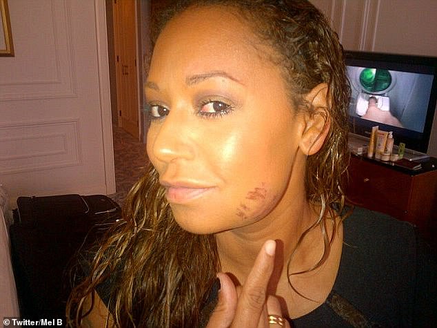 Mel tweeted a photo of her injury in 2012 , but later alleged in 2017 that her scrape was from Belafonte punching her with a closed fist and pushing her down on the carpet