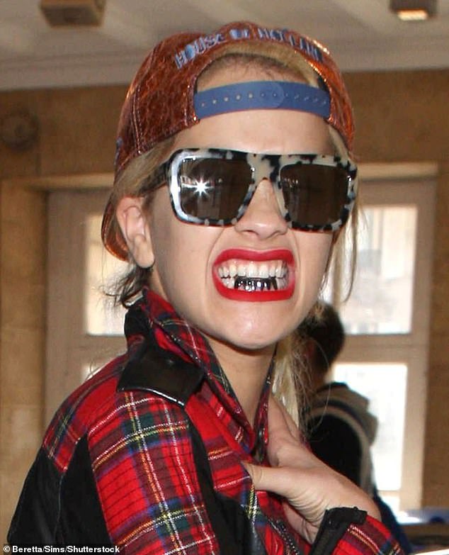 Rita, 33, was most notably spotted donning shiny grills in October 2013 at Paris Fashion Week, when she flashed a smile to photographers