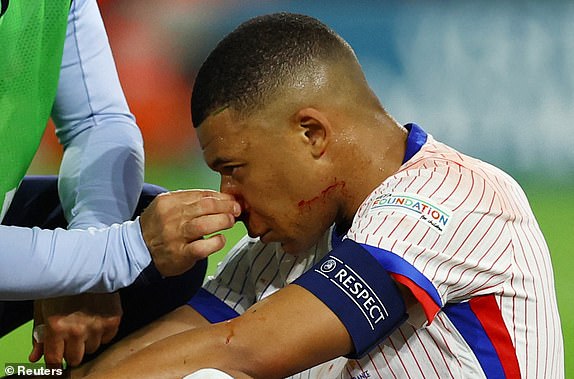 Soccer Football - Euro 2024 - Group D - Austria v France - Dusseldorf Arena, Dusseldorf, Germany - June 17, 2024 France's Kylian Mbappe reacts after sustaining an injury REUTERS/Kacper Pempel