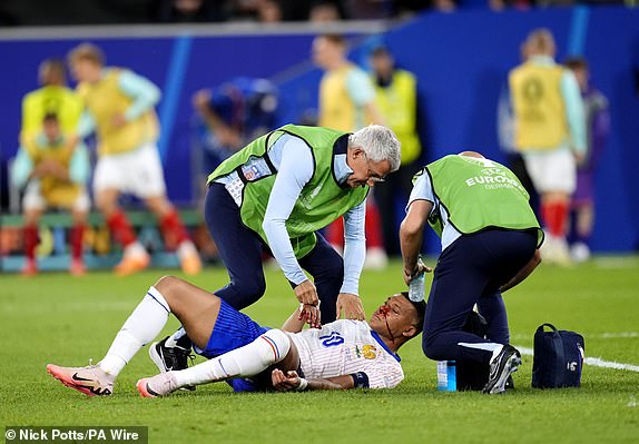 EDITORS NOTE: GRAPHICFrance's Kylian Mbappe requires medical attention after colliding with Austria's Kevin Danso (not pictured) during the UEFA Euro 2024 Group D match at the Dusseldorf Arena in Dusseldorf, Germany. Picture date: Monday June 17, 2024. PA Photo. See PA Story SOCCER Austria. Photo credit should read: Nick Potts/PA Wire.RESTRICTIONS: Use subject to restrictions. Editorial use only, no commercial use without prior consent from rights holder.