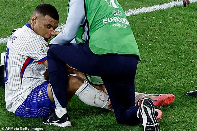 Mbappe was forced off against Austria when he broke his nose in a collision with Kevin Danso