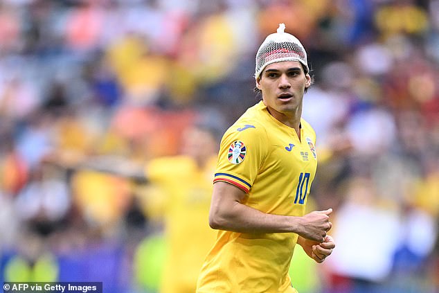 Fans have been left baffled after Romania star Ianis Hagi wore a netting on his head