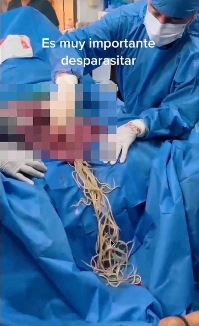 Shown above is a screen grab from the video, which was claimed to show a horse with a bowel obstruction having its intestines cut open before the worms are removed