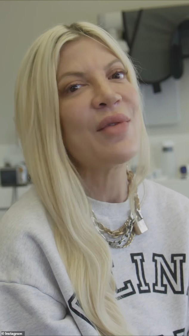 Tori Spelling has given fans an inside look into the veneer procedure that raised her confidence levels and got her 'smiling again'