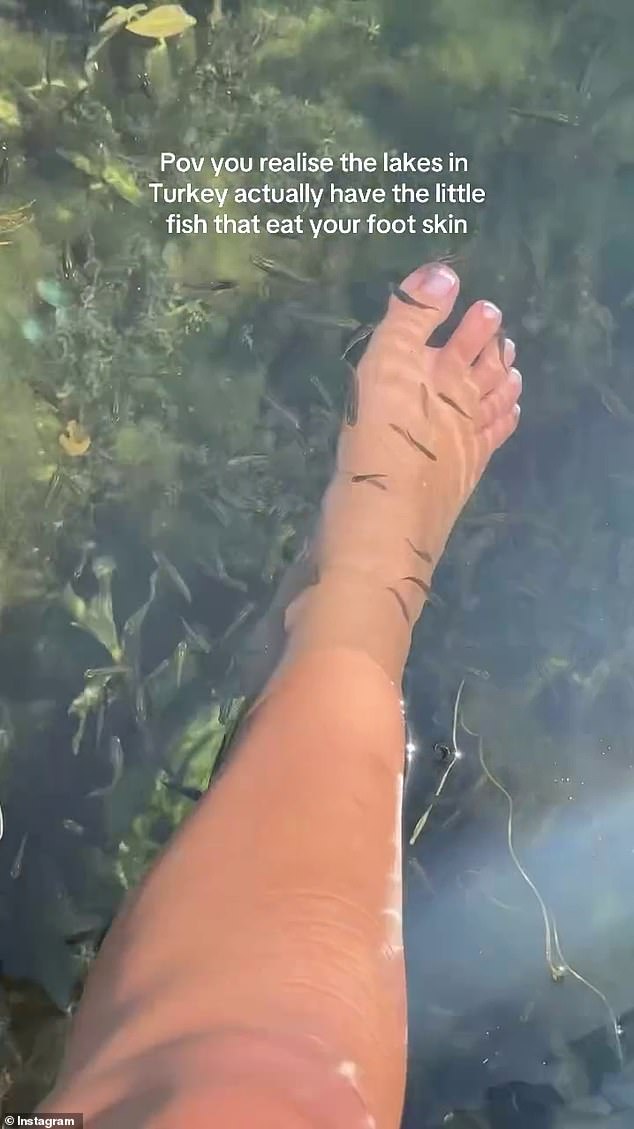 Anna's caption, 'Pov you realise the lakes in Turkey actually have the little fish that eat your foot skin,' sparked a flurry of concern among fans