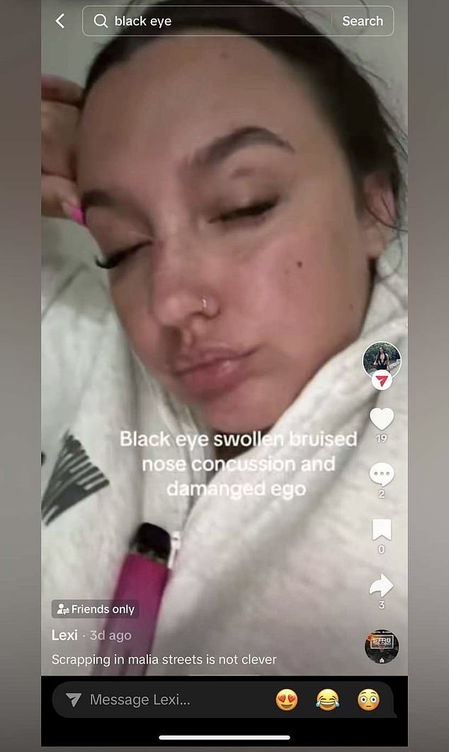 The TikTok, captioned 'Scrapping in Malia streets is not clever', shows the young woman with several injuries, including a black eye, a swollen and bruised nose