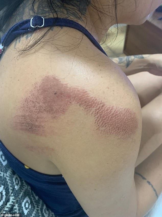 Brazilian school principal Raquel Schwab suffered multiple bruises after she was dragged by a driver, whom she asked to not park on the school sidewalk