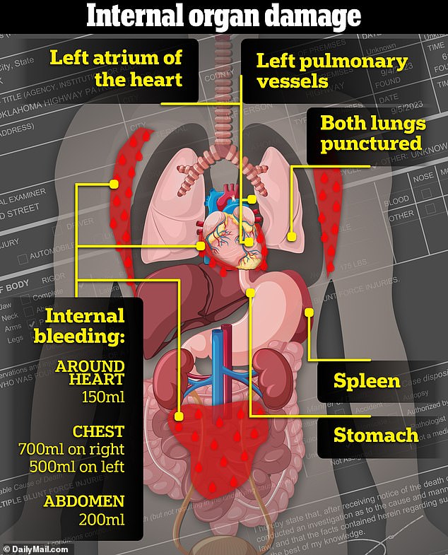 Presgrove is believed to have died from massive internal bleeding before his other injuries had a chance to end his life. All up, he lost at least 3.2 pints of blood from two punctured lungs, damage to vital organs, and extensive tissue damage. A man Presgrove's size has about 12.6 pints of blood, and would generally die after losing half of it - though as little as a third can lead to death