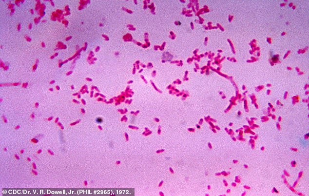 Researchers were 'surprised' that patients with head and neck cancer who had Fusobacterium (seen) within their tumours had 'much better outcomes'