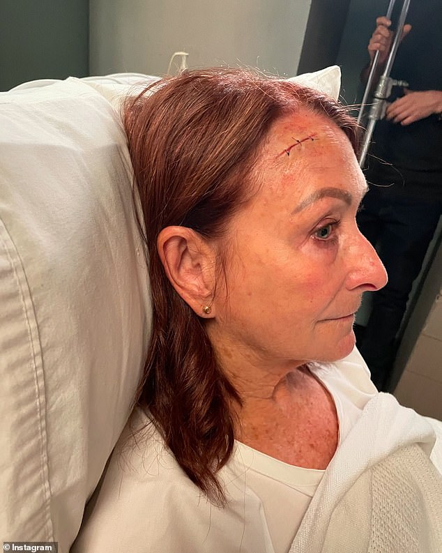 The Home and Away veteran posted the images to Instagram on Tuesday - but luckily, it was all just special effects makeup