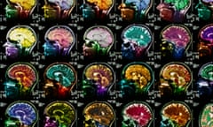 Coloured sagittal MRI scans of the human brain